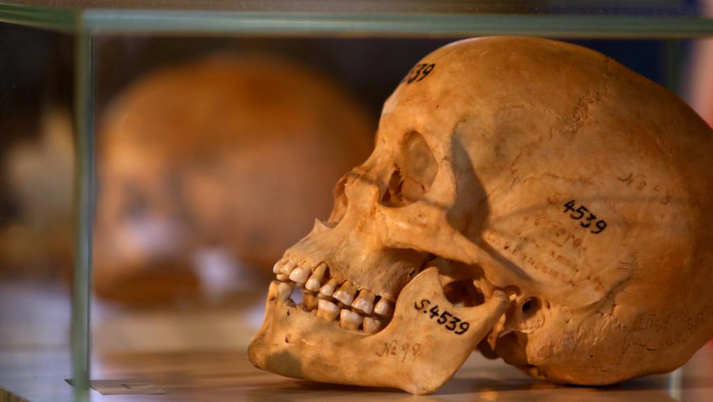 Génocide des Hereros et Namas de Namibie : Les ossements en attendant la repentance ? Génocide des Hereros et Namas de Namibie : Les ossements en attendant la repentance ?